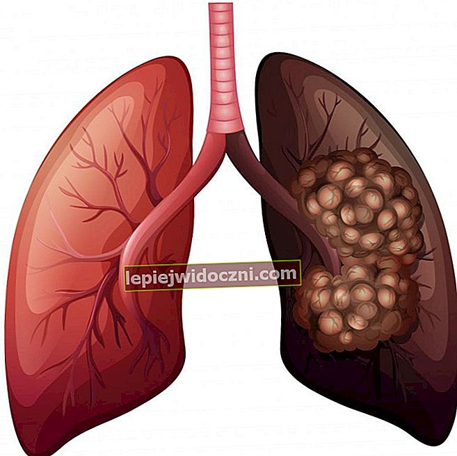 Ролята на белите дробове в отделителната система на човека