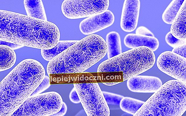 Arheobacterii și tipuri